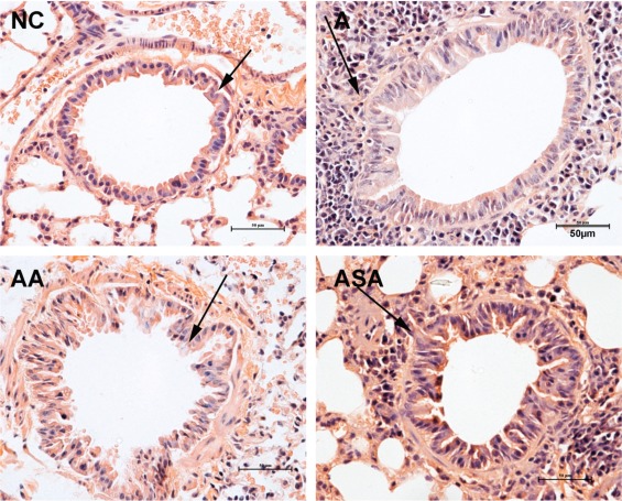 魏颖-2017-Regulation of hypothalamic-pituitary-adrenal axis activity and immunologic function contributed to the anti-inflammatory effect of acupuncture in the OVA-induced murine asthma model.jpg