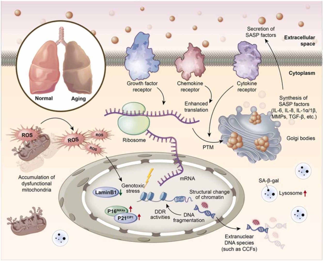 Cytokine Growth Factor Rev | 复旦大学董竞成团队系统性评述细胞衰老在肺部炎症性疾病中的作用及研究进展